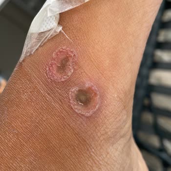 Otel Tatilinde Sağlık Sorunları Ve İlgisizlik Mağduriyeti