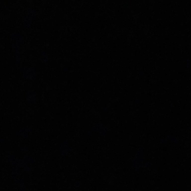 Karbon Peeling İşlemi Ve Ürünlerden Hiçbir Fayda Görmedim, Çözüm Sunulmadı