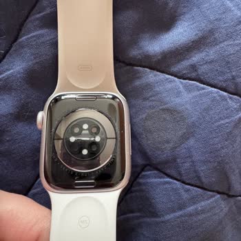 Apple Watch Kullanımı Sonrası Bilekte Ciddi Tahriş Ve İlgisizlik Mağduriyeti