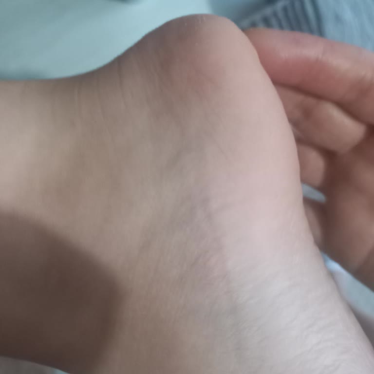 Çocuğumun Sağlığını Tehdit Eden Terlik İçin Değişim Talebim Reddedildi