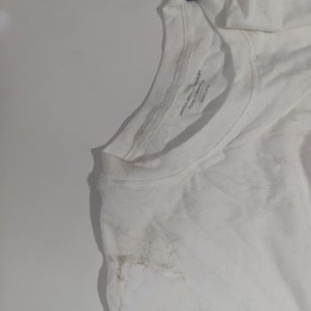 Kargom Bahçeye Fırlatıldı, Ürünüm Zarar Gördü Ve Mağdur Edildim