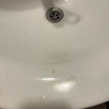 Pineta Club Ve Park Delux Otelde Temizlik Ve Hizmet Sorunları