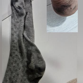 İnci Ayakkabı Siyah Ayakkabının Boyası Çorabıma Ve Ayağıma Geçti