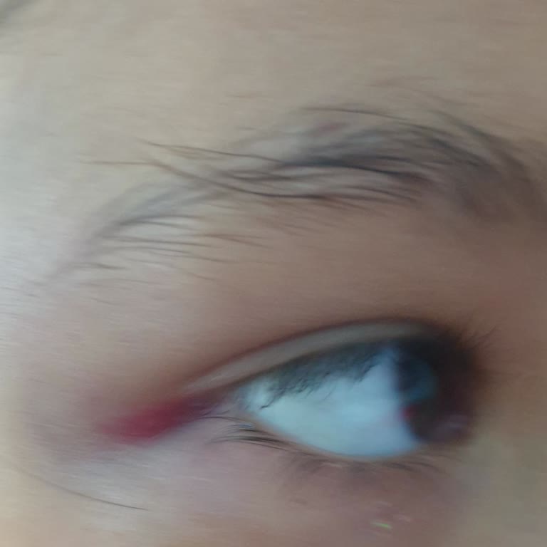 Vikingen Infinity Resort'ta Sağlık Ve Güvenlik Sorunları Yaşadık