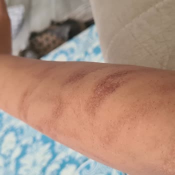 Randevuya Rağmen Bekletildim Ve Annem Odaya Alınmadı, İşlemde Acı Çektim