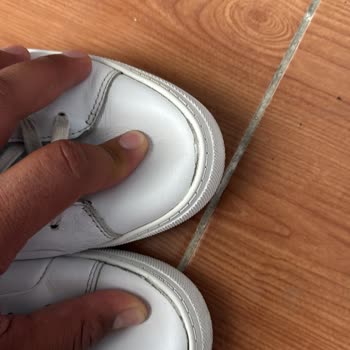 Tommy Ayakkabılarımın Yanları Kısa Sürede Açıldı Garanti Reddedildi