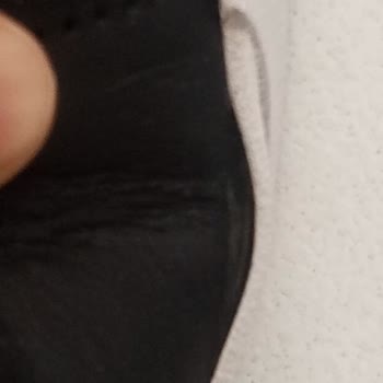 Tommy Ayakkabılarımın Yanları Kısa Sürede Açıldı Garanti Reddedildi