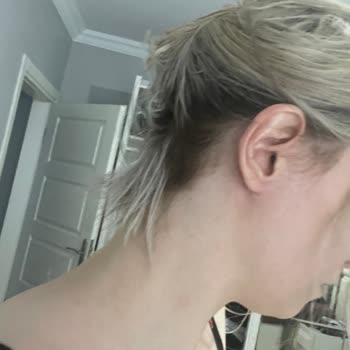 Aslı Öztürk Beauty Bar Saçlarım Koptu