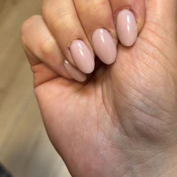 Jel Tırnak Uygulaması Sonrası Deformeler Ve İletişimsizlik Mağduriyeti