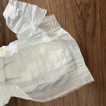 Aldığım Molfix Bezlerin Yarısı Yırtık Ve Kullanılamaz Çıktı