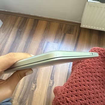 10 Yıllık Apple Sadakati Çizik Bahanesiyle Hiçe Sayıldı