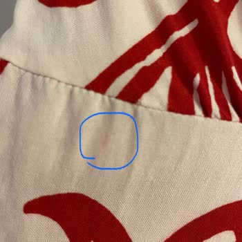 Yıkamada Renk Veren Elbise, H&M Ve Trendyol Sorumluluk Almıyor!