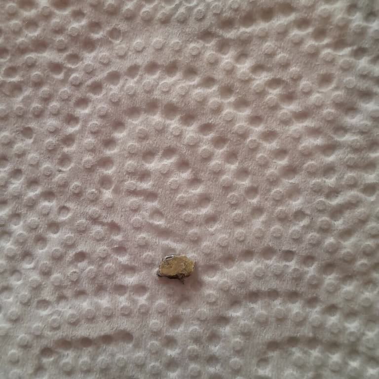 Gıda Ürününde Yabancı Madde ve Müşteri Hizmetleri İlgisizliği Şikayeti