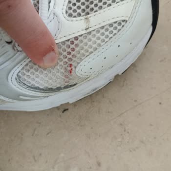 Kısa Sürede Yırtılan New Balance Ayakkabılar İçin Değişim Talebi