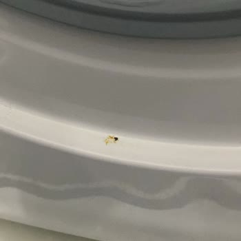 Vestel Çamaşır Makinesinde Tekrarlayan Arızalar Ve Garanti Kapsamı Sorunu