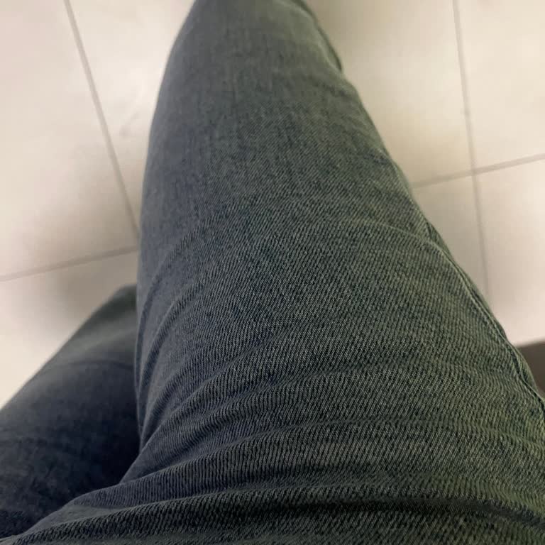 Satın Aldığım Pantolonun Hızlı Deformasyonu Ve Değişim Talebimin Reddedilmesi