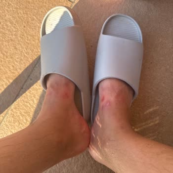 Satın Aldığım Terlik Ayağımı Rahatsız Ediyor, İade Talep Ediyorum