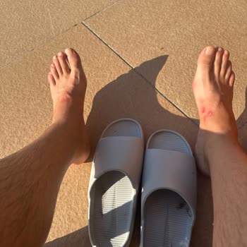 Satın Aldığım Terlik Ayağımı Rahatsız Ediyor, İade Talep Ediyorum