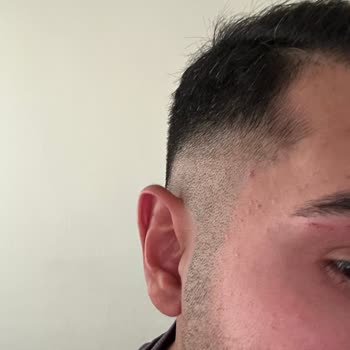 Eczaneden Alınan Yüz Yıkama Jeli Cildimi Bozdu, İlgisiz Yaklaşım