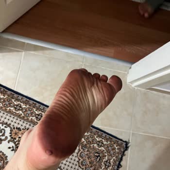 Sandalet Boyası Ayağımı Lekeliyor, İade Talebim Reddedildi