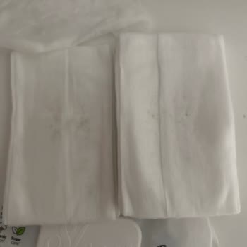 Bebeğime Aldığım Islak Mendilde Küf Kokusu Ve Sağlık Endişesi