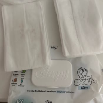 Bebeğime Aldığım Islak Mendilde Küf Kokusu Ve Sağlık Endişesi