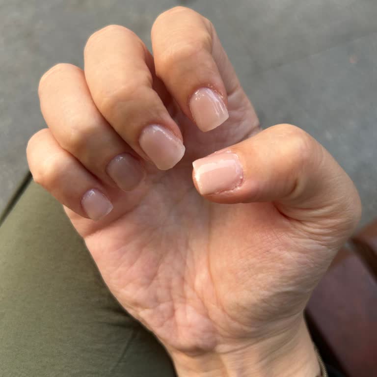 Protez Tırnak Hizmetinde Özensiz İşçilik Ve Mağduriyet