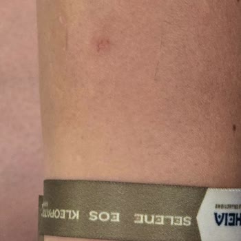 Duş Camı Kırıldı, Yaralandım Ve Otel Yönetimi İlgisiz Kaldı