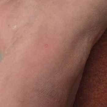 Duş Camı Kırıldı, Yaralandım Ve Otel Yönetimi İlgisiz Kaldı