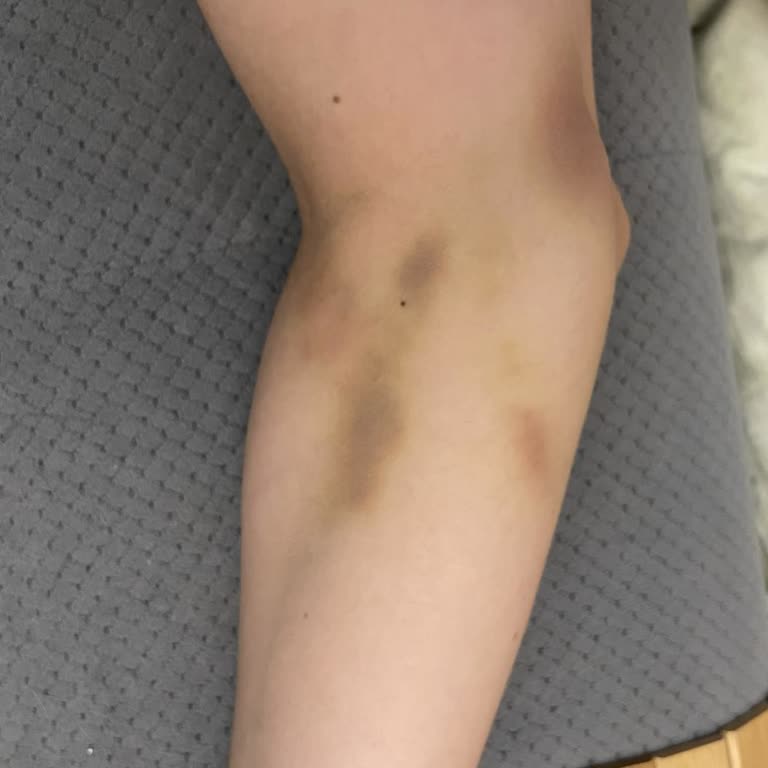 Erdem Hastanesi İlgisizlik Ve Mağduriyet Zinciri