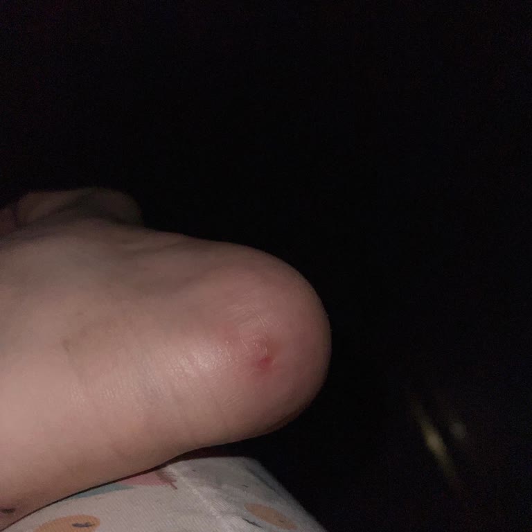 5000 TLye Alınan Ayakkabının Kısa Sürede Yırtılması Ve Garanti Mağduriyeti