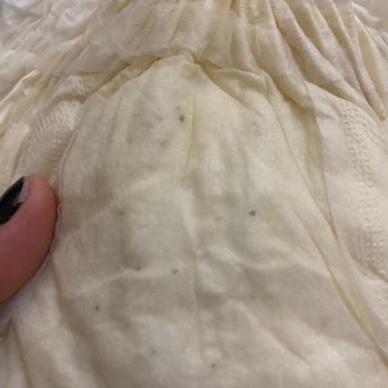 Aldığım Bebek Bezlerinde Küf Sorunu Ve Sağlık Endişesi