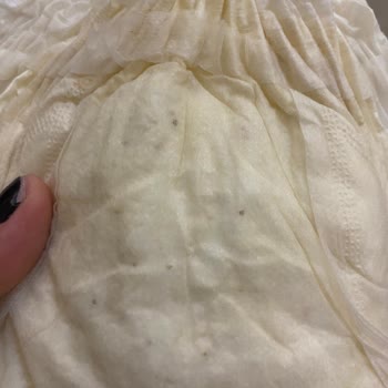 Aldığım Bebek Bezlerinde Küf Sorunu Ve Sağlık Endişesi