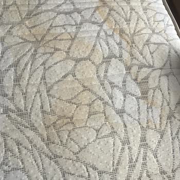 Çocuk Odası Takımında Sararma Sorunu Ve Müşteri Hizmetleri Yaklaşımı