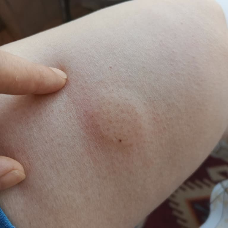 I Paid ₺150 for Off Mosquito Repellent That Doesn’t Work at All