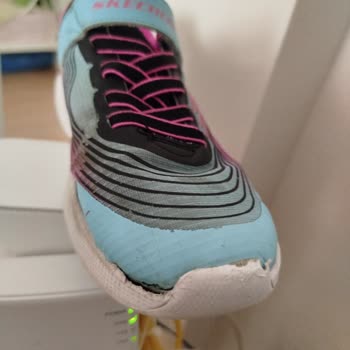 Skechers Ayakkabıda 1 Ayda Yırtılma Ve Kötü Koku: Değişim Talebim Var