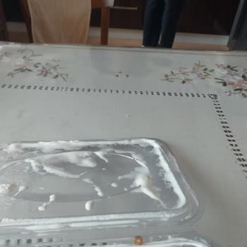 Kerebiçten Çıkan Taş Dişime Zarar Verdi İade Talebim Reddedildi