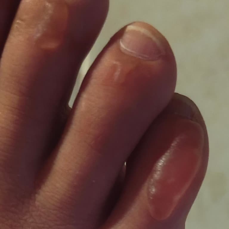 İade Talebim Gerekçesiz Reddedildi, Sağlık Sorunum Dikkate Alınmadı