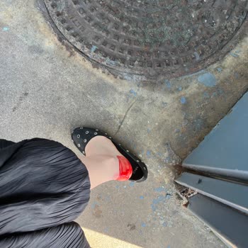 Aldığım Ayakkabının Ayağımı Kesmesi Sonucu Sağlık Sorunu Ve Mağduriyet Yaşadım