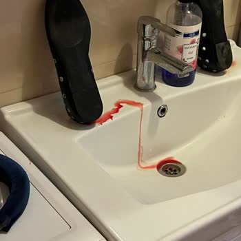 Aldığım Ayakkabının Ayağımı Kesmesi Sonucu Sağlık Sorunu Ve Mağduriyet Yaşadım