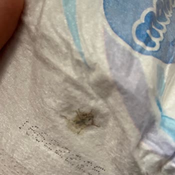 Bebek Bezinde Böcek Ve Kalıntı Şoku, İletişimsizlik Mağduriyeti