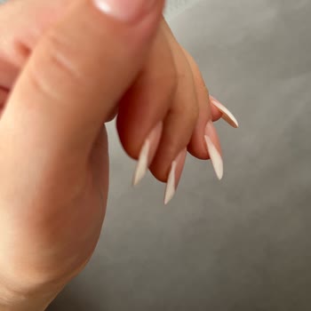 Fiyat Farkı Ve Profesyonellik Sorunu