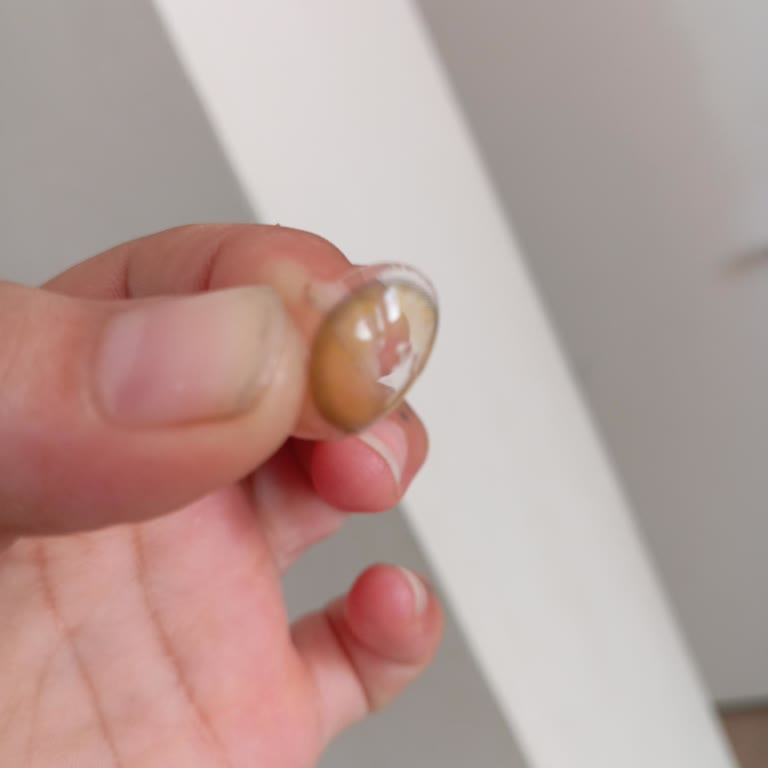 Aldığım Lens İlk Kullanımda Hasarlı Çıktı, Mağduriyetim Giderilmiyor