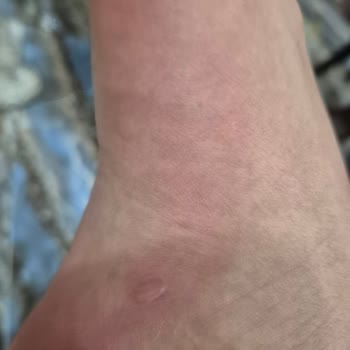 Orijinal Cross Terlik Ayağımı Mahvetti, Tatilim Zehir Oldu