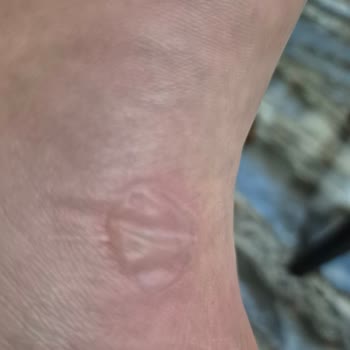 Orijinal Cross Terlik Ayağımı Mahvetti, Tatilim Zehir Oldu