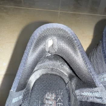 Kısa Sürede Deforme Olan Ayakkabıya İade Reddi Ve Mağduriyet