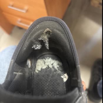 Skechers Ayakkabı Kısa Sürede Yıprandı, Garanti Süreci Mağduriyet Yarattı