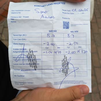 Yeni Aldığım Lens Sağ Gözümde Batma Ve Ağrıya Neden Oluyor