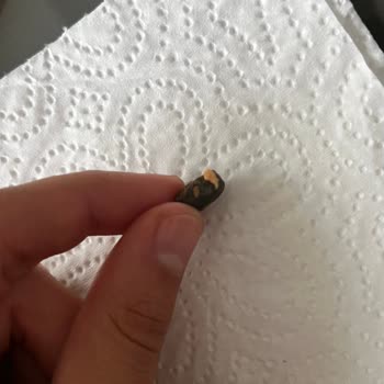 Kuruyemiş Paketinden Taş Çıktı, Dişim Kırıldı