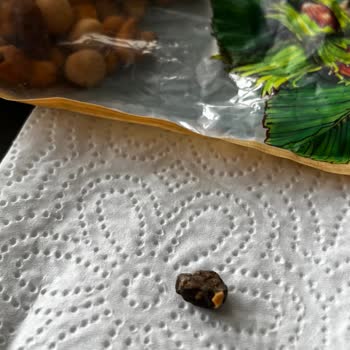 Kuruyemiş Paketinden Taş Çıktı, Dişim Kırıldı